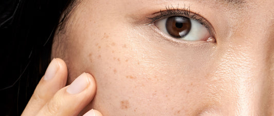 Say Goodbye to Dark Spots: The Best Ingredients for Brighter, Even-Toned Skin