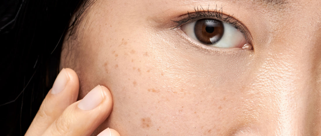 Say Goodbye to Dark Spots: The Best Ingredients for Brighter, Even-Toned Skin