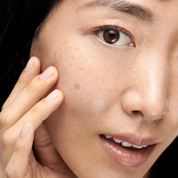 dryness and dehydration