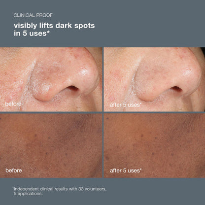 50ml